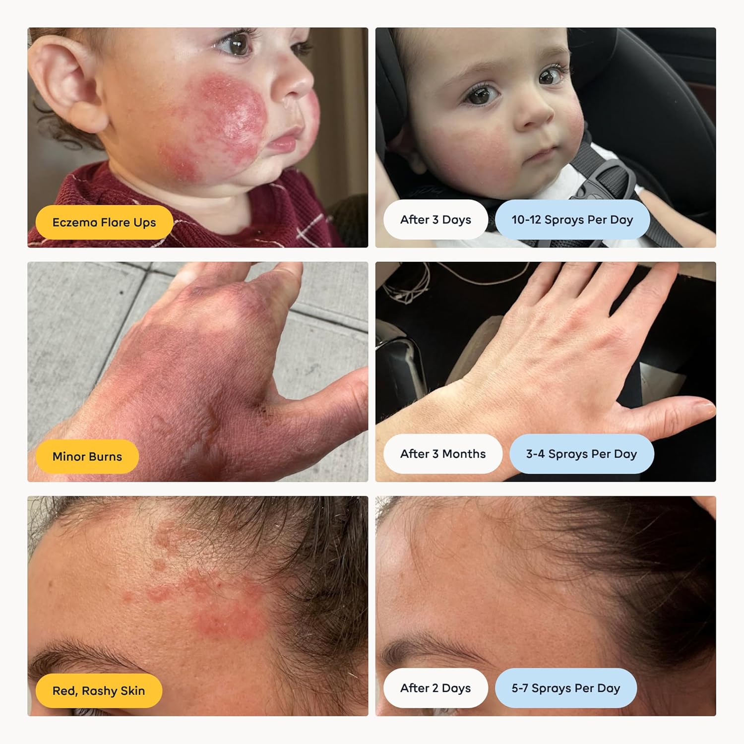 MAGIC MOLECULE Hypochlorous Acid Spray